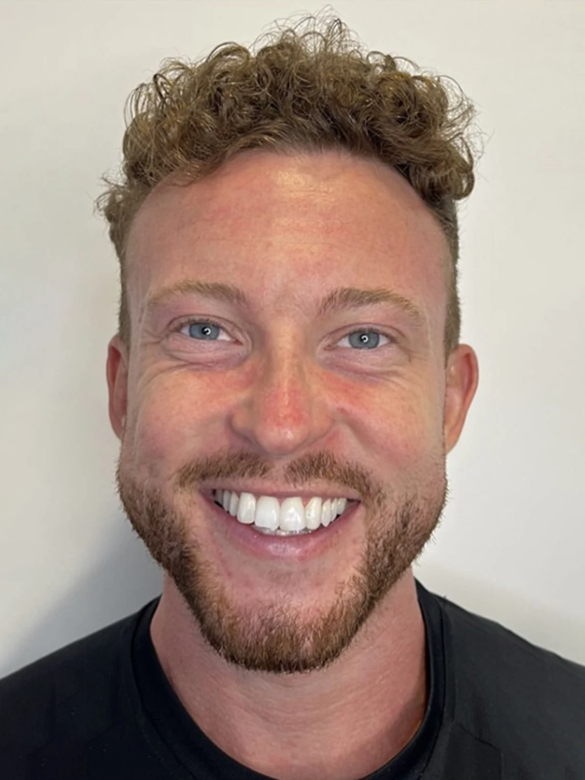 After
